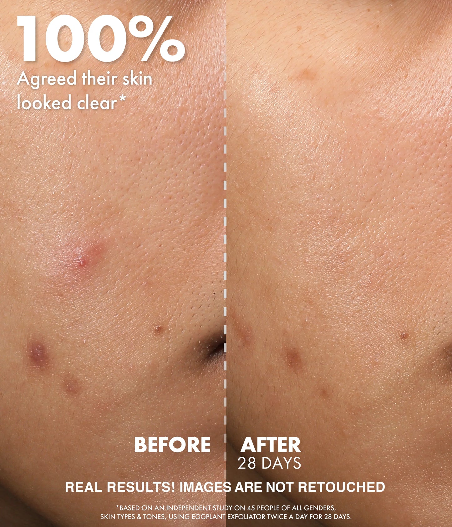 WISHFUL Eggplant Exfoliator: 9.5% AHA, BHA & PHA Pore Clarifying Daily Toner